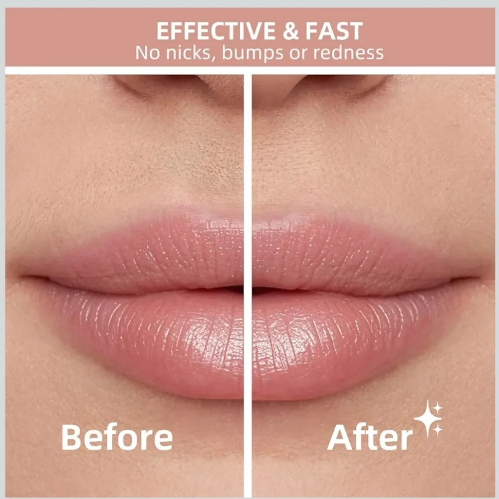 Facial Hair Remover - White - Picture 3 of 12